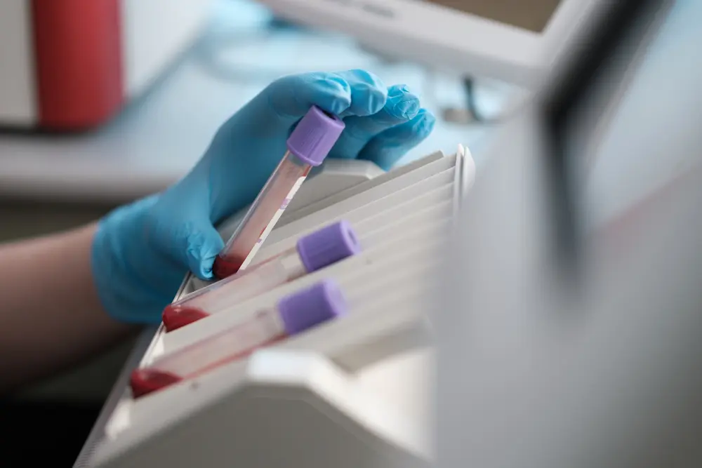 Analyse laboratoire